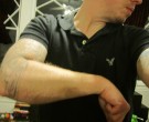 7 years and 10 Months on Testosterone - Forearms